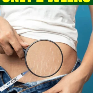 outils de soins de la peau post partum, produits pour les vergetures corporelles