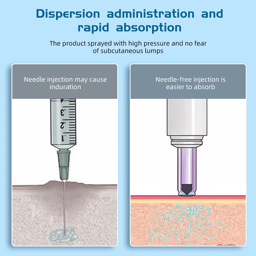 injecteur d'insuline indolore : soin du diabète facile et doux, la nouvelle seringue réglable sans aiguille, réduit la glycémie injecteur d'insuline indolore : soin du diabète facile et doux, la nouvelle seringue réglable sans aiguille, réduit la glycémie